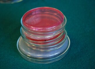 Czy pożywka dla drożdży jest konieczna? Czy pożywka dla drożdży jest konieczna?