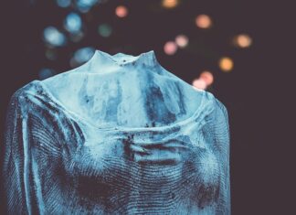 Gdzie zgłosić uszkodzona studzienkę?